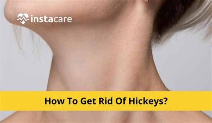 Are hickeys painful?