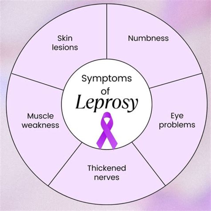 Are there any lepers today?