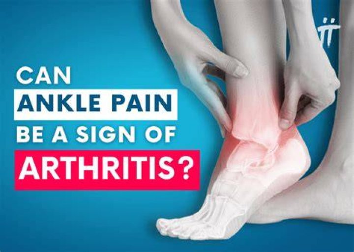 Can a broken ankle cause arthritis?