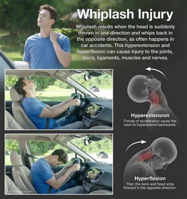 Can a chiropractor fix whiplash injury?
