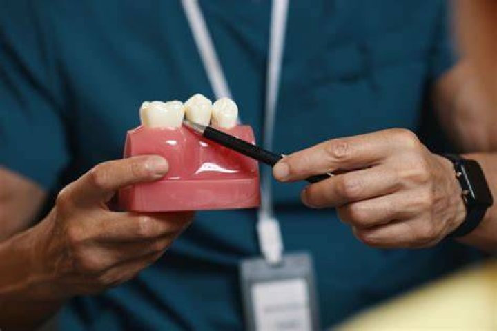 Can a dentist remove hardened plaque?