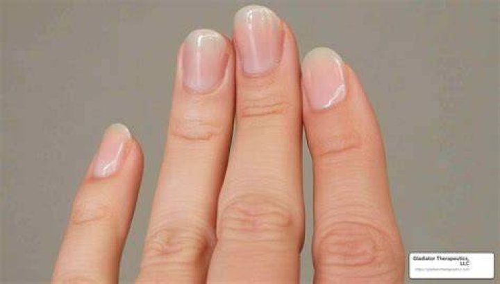 Can a finger grow back?