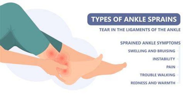 Can a sprain heal wrong?
