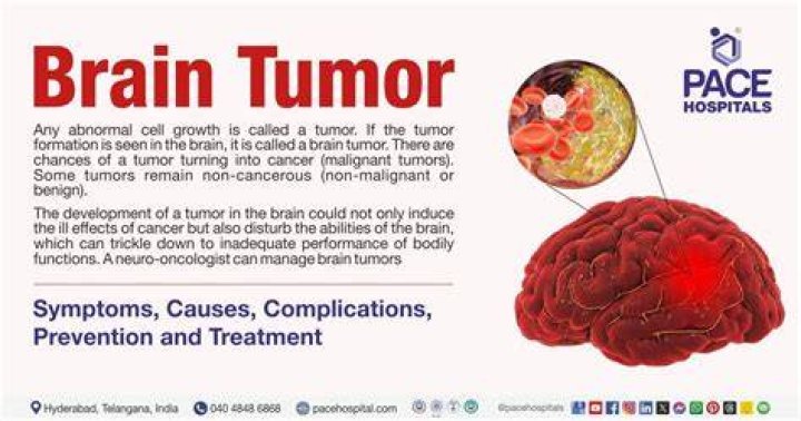 Can a virus cause a brain tumor?
