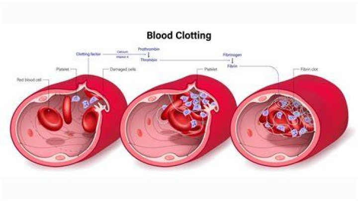 Can amoxicillin cause blood clots?