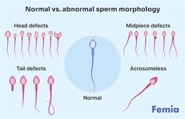Can an abnormal sperm fertilize an egg?
