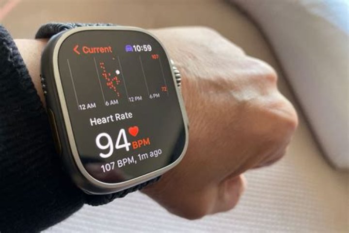 Can Apple Watch cause health problems?