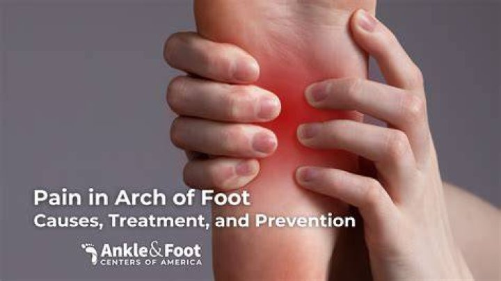 Can arch support cause ankle pain?