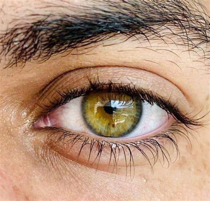 Can eyes be green?