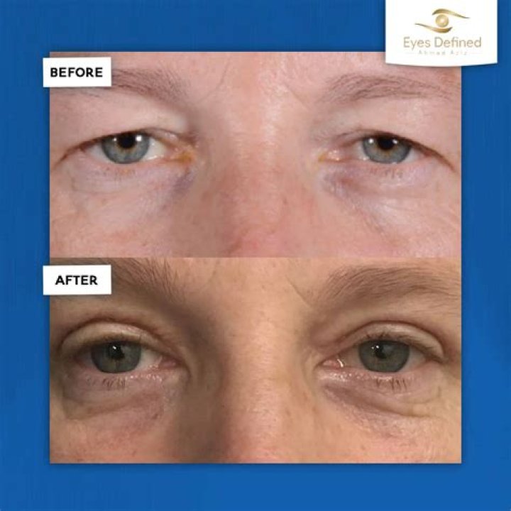 Can eyes repair themselves?