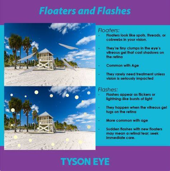 Can floaters cause blindness?