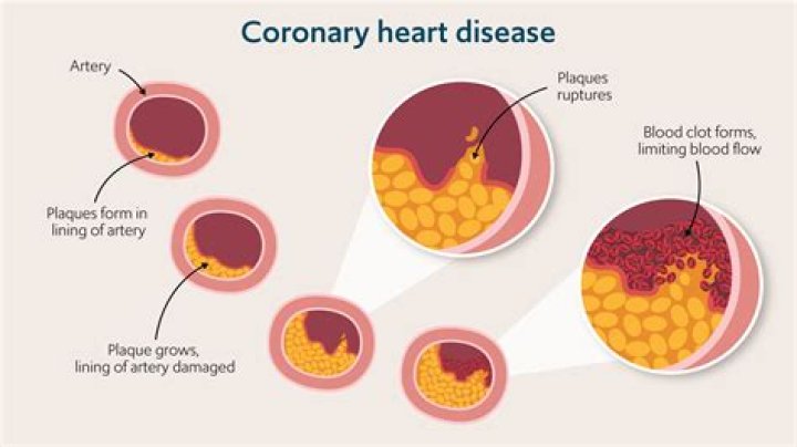 Can Gatorade affect your heart?