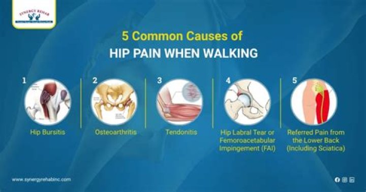 Can high arches cause hip pain?