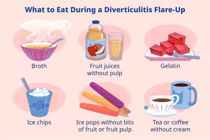 Can I drink coffee with diverticulitis?