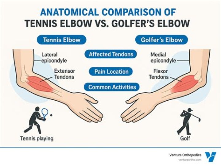Can I play both tennis and golf?