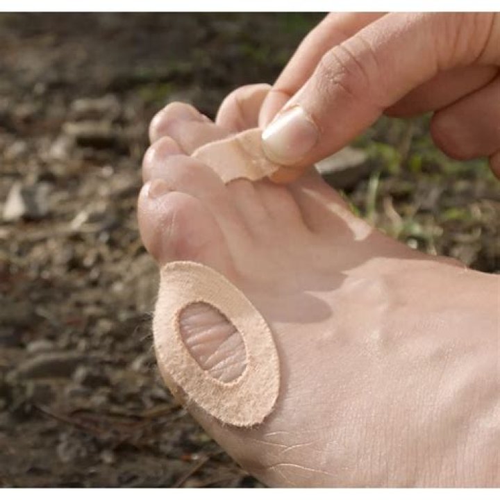 Can I put moleskin over blister?