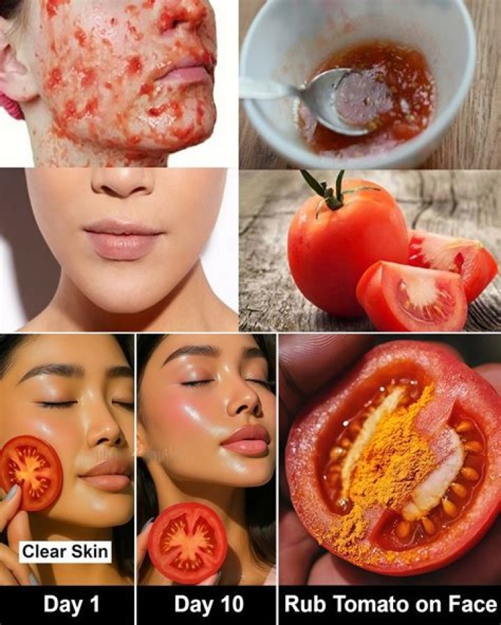 Can I rub tomato on face daily?