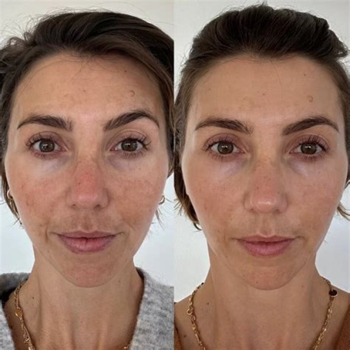Can I shave my face before a facial?
