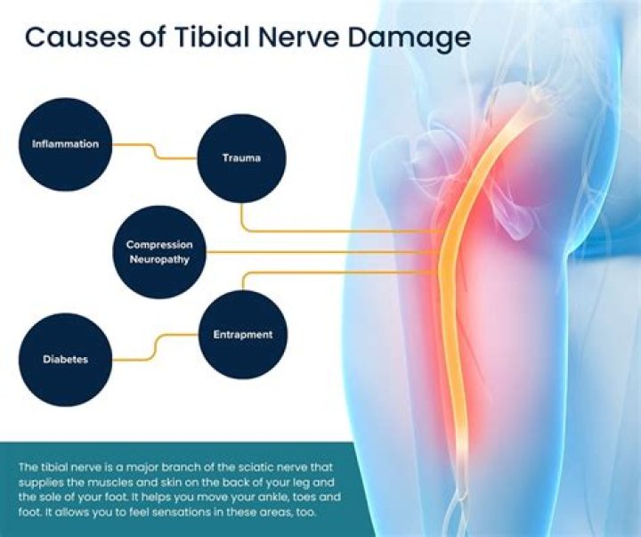 Can labral tear cause nerve damage?