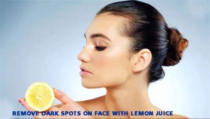 Can lemon remove dark spots?