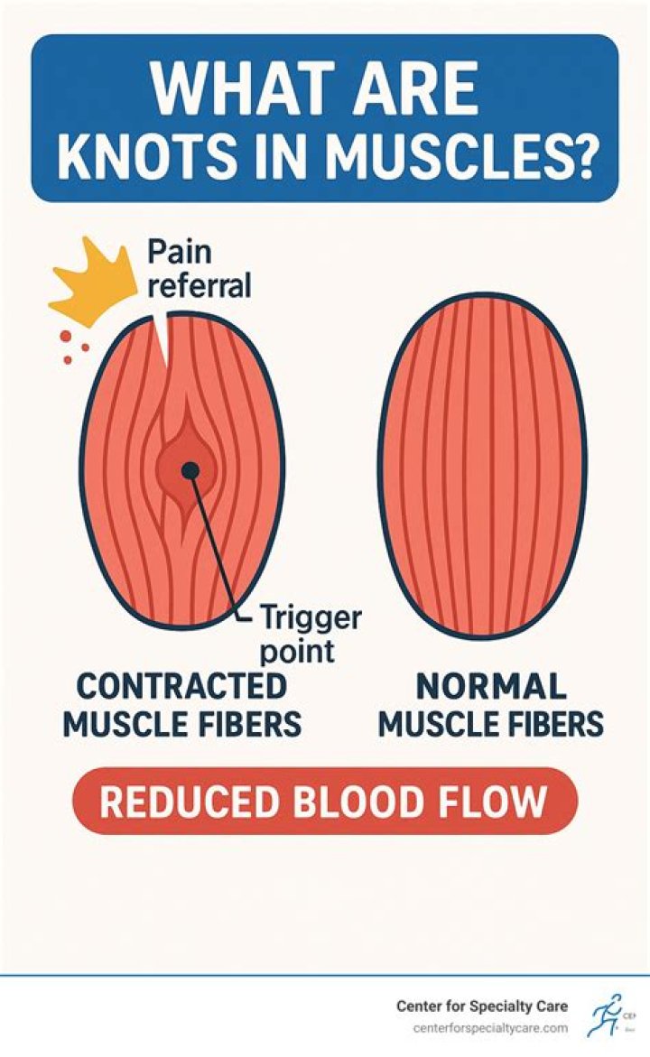 Can massage cause muscle knots?