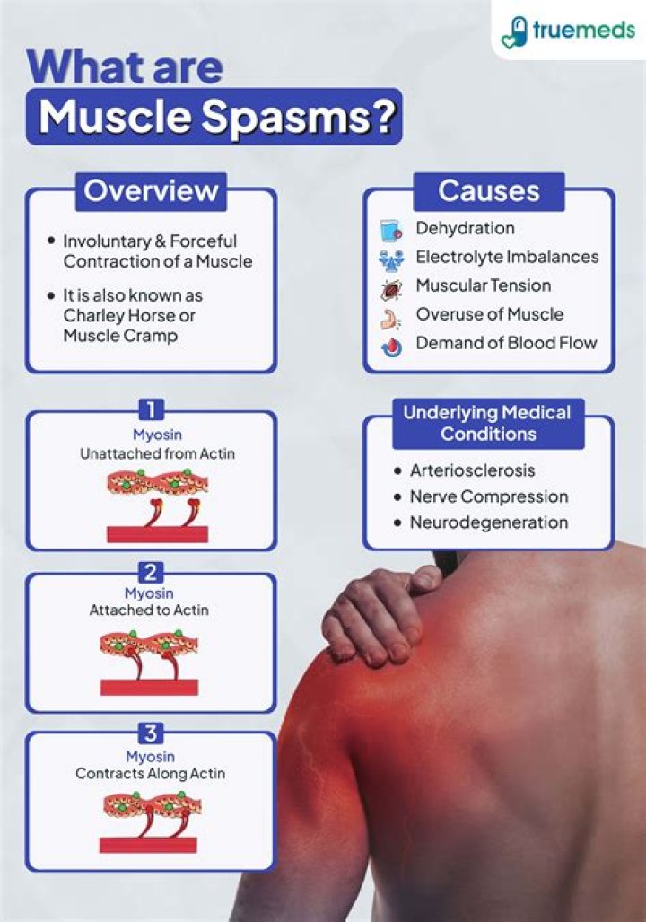 Can MRI detect muscle spasm?