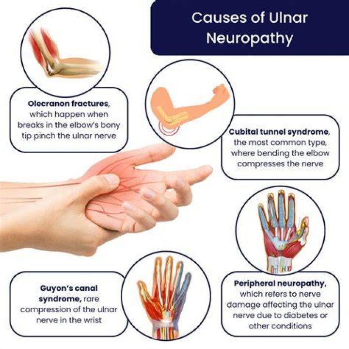 Can neuropathy affect your eyes?