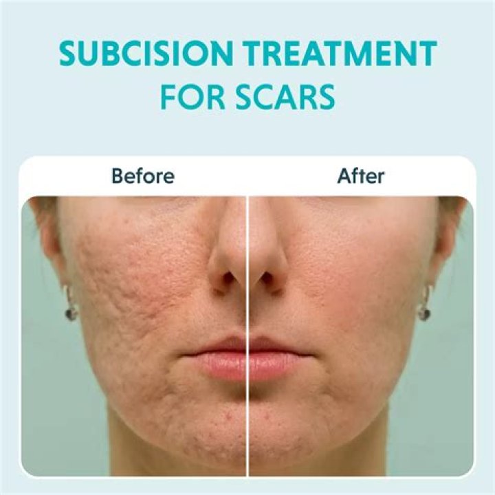 Can old scars become infected?