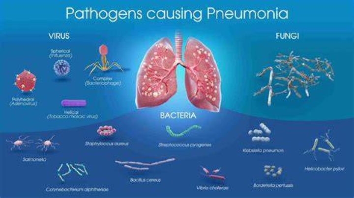 Can pneumonia be fatal?