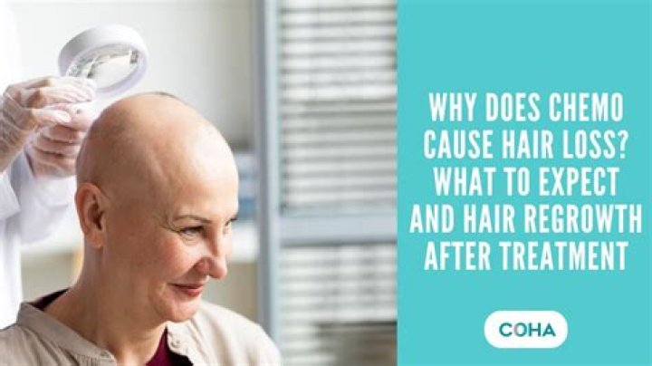 Can Sjogren's cause hair loss?
