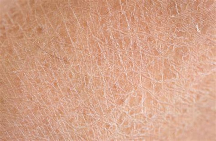Can skin elasticity be restored?