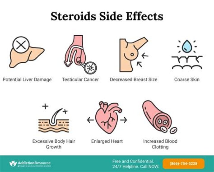 Can steroids cause aphasia?