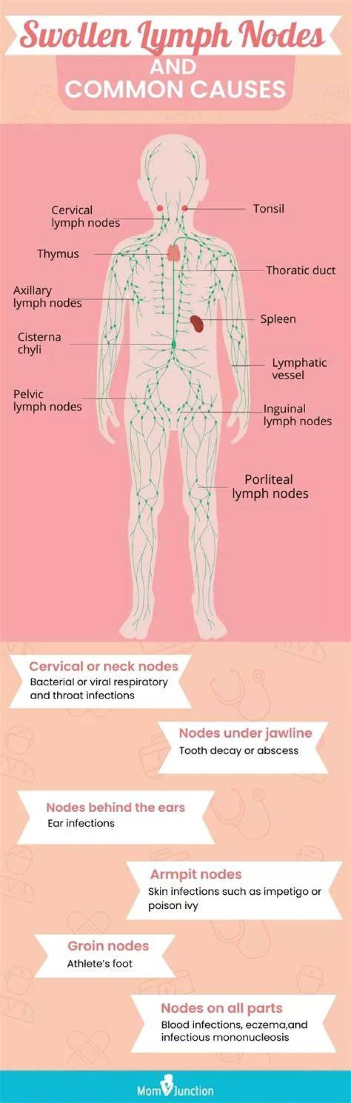 Can stress cause lymph nodes to swell?