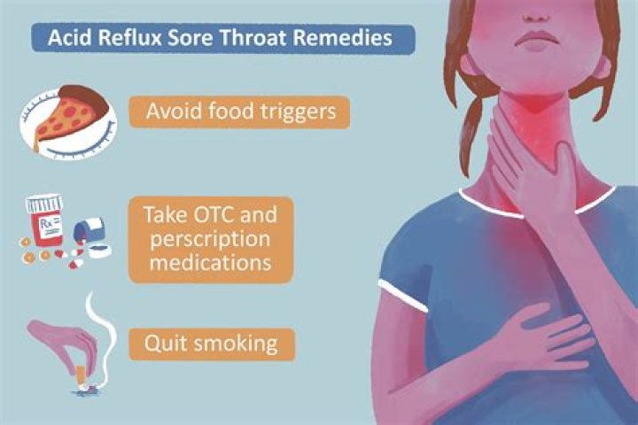 Can throat lozenges cause acid reflux?