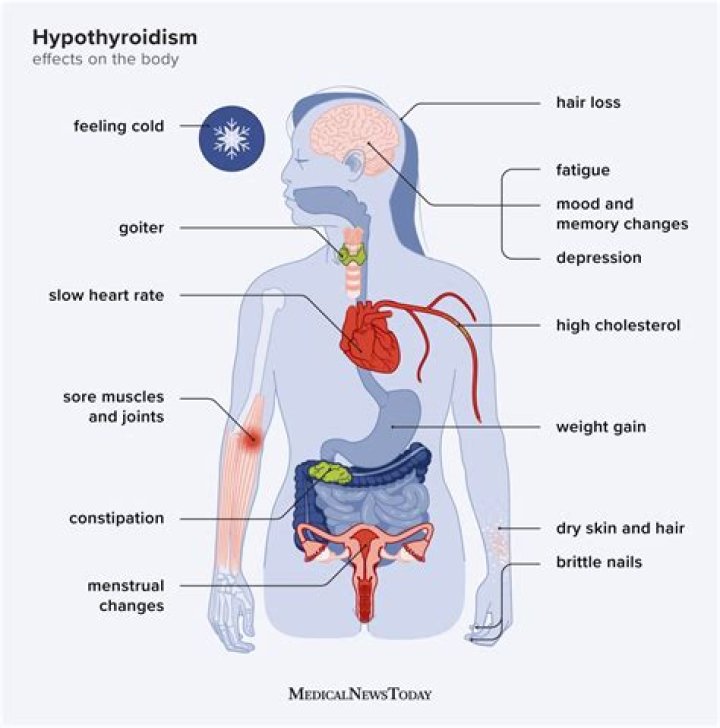 Can thyroid affect your stomach?