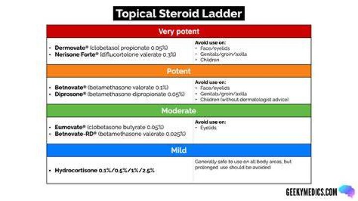 Can topical steroids help tendonitis?