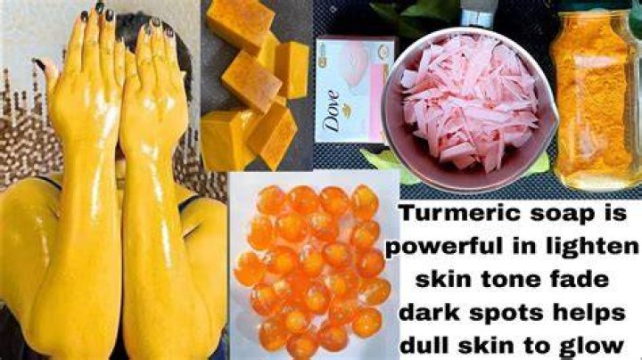 Can turmeric remove pimples?