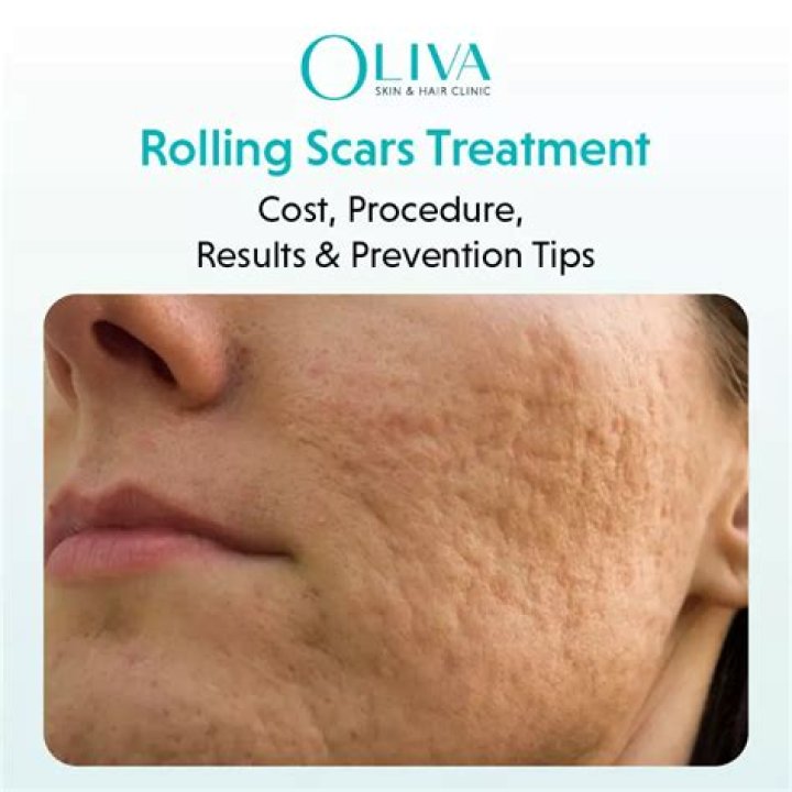 Can vitamin E make scars worse?