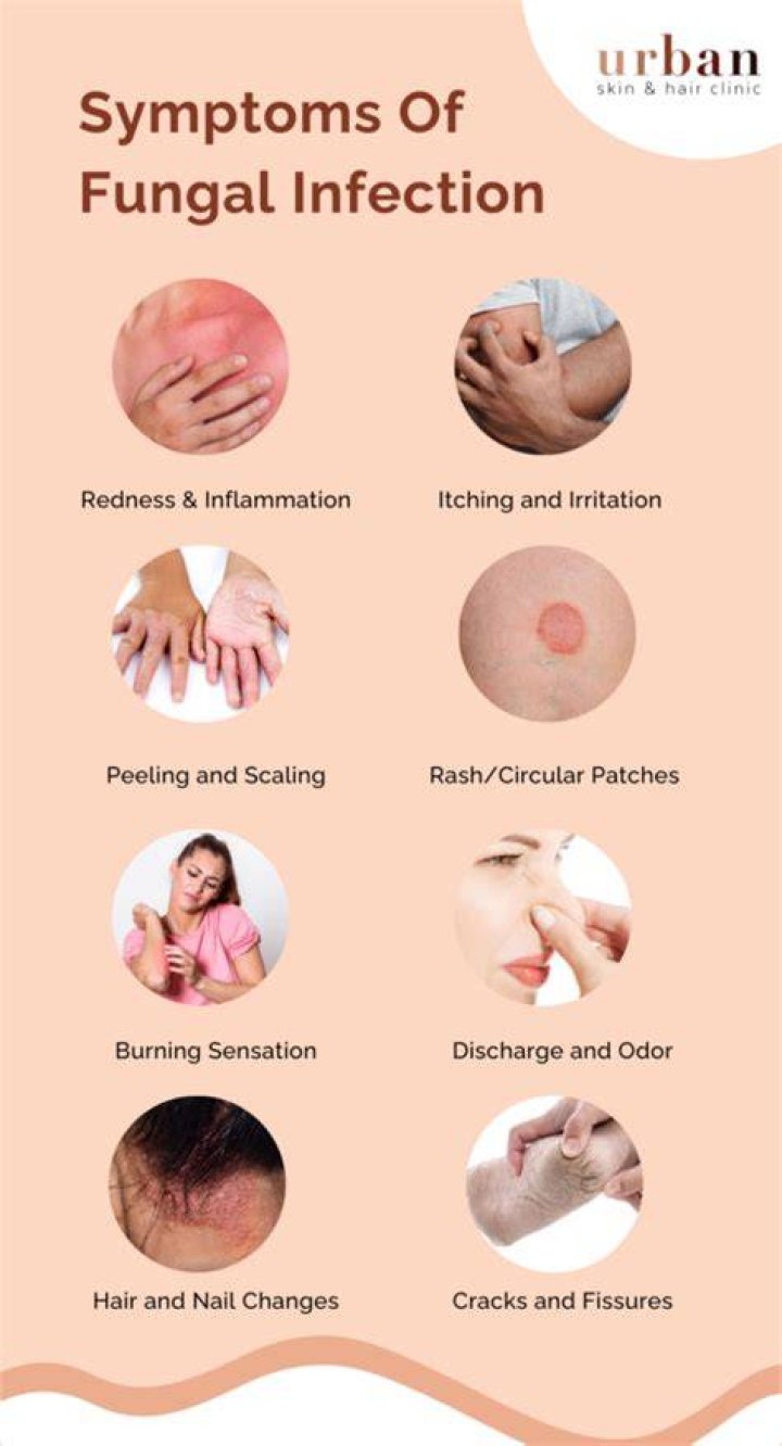 Can we apply neem paste on fungal infection?
