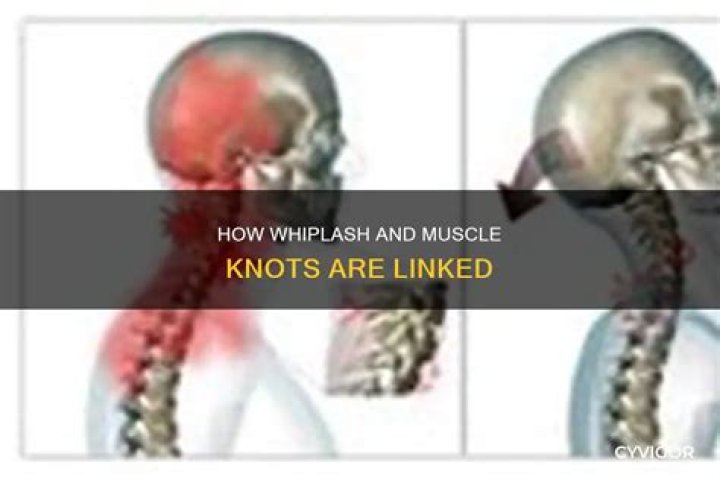 Can whiplash cause muscle knots?