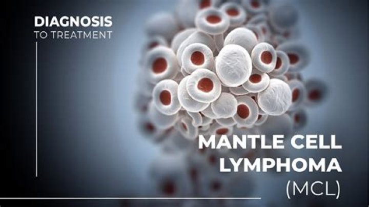 Can you beat mantle cell lymphoma?