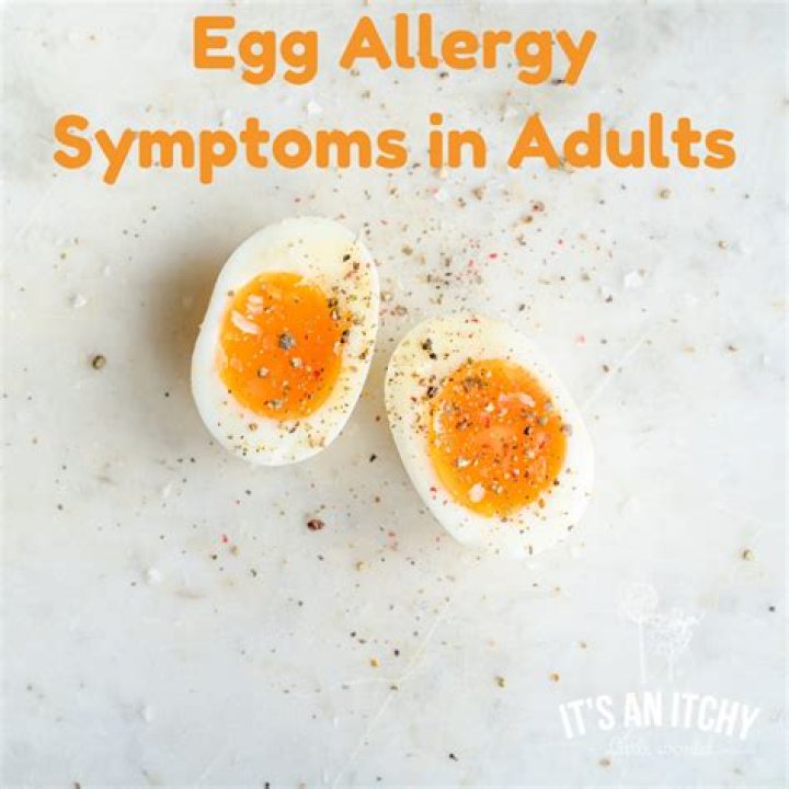 Can you become allergic to eggs all of a sudden?