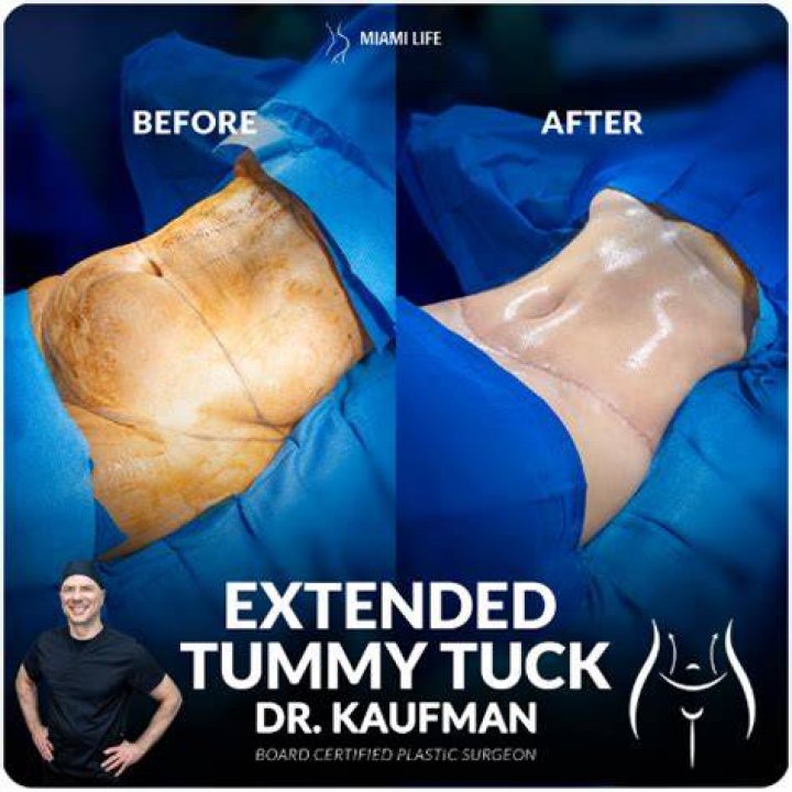 Can you do a tummy tuck and thigh lift at the same time?