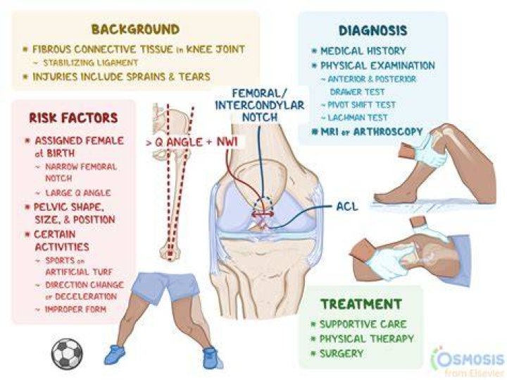 Can you flex your knee with a torn ACL?