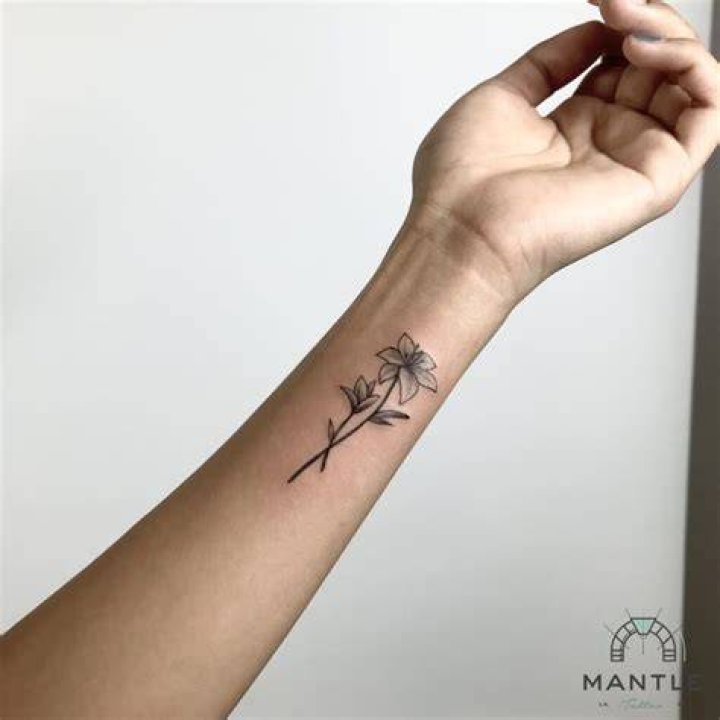 Can you get a tattoo removed in the army?