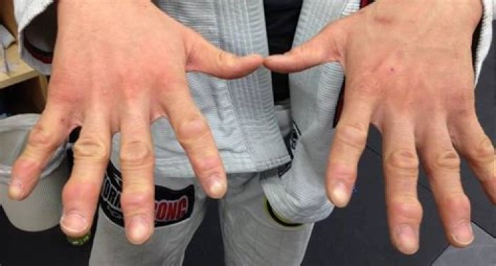 Can you grab fingers in Jiu Jitsu?