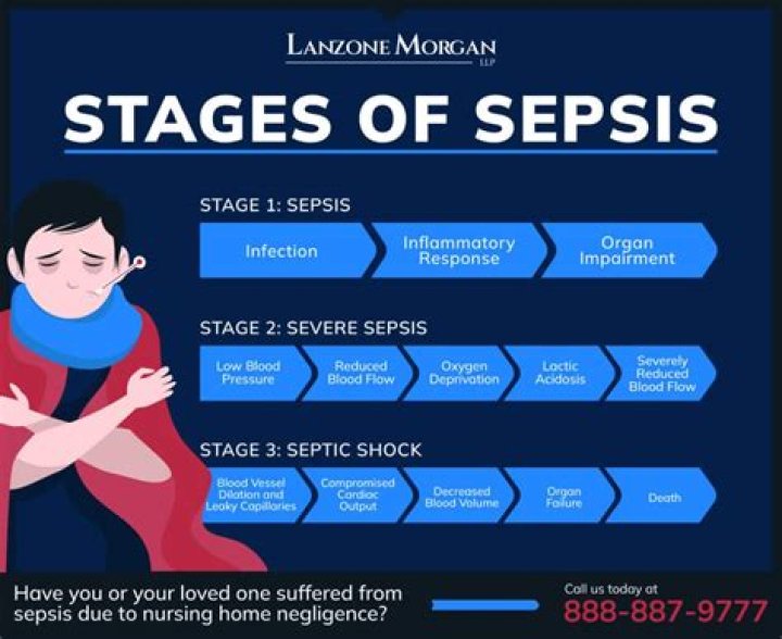 Can you have sepsis without symptoms?
