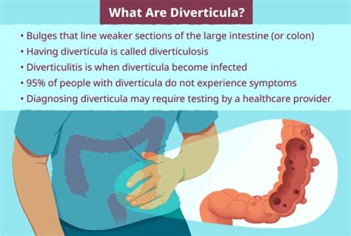 Can you live a long life with diverticulitis?