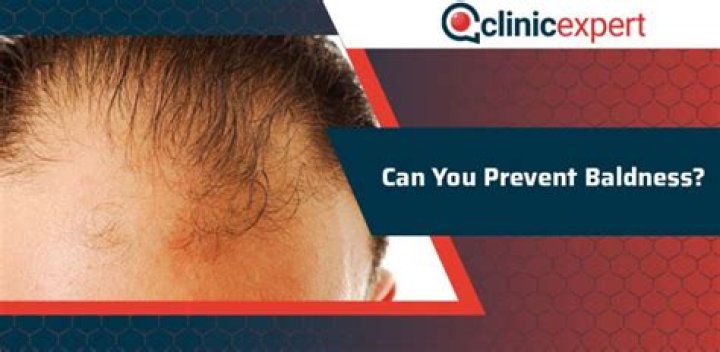 Can you prevent baldness?
