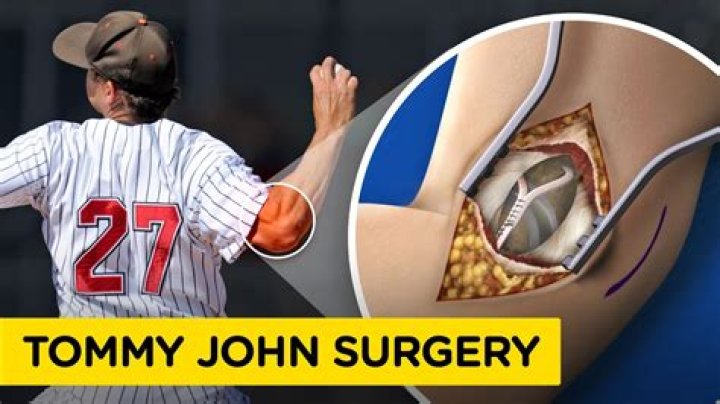 Can you still pitch after Tommy John surgery?